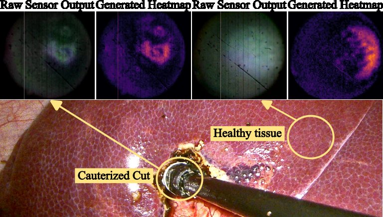 Endoscope view of MISTac on a liver cut with matching tactile images